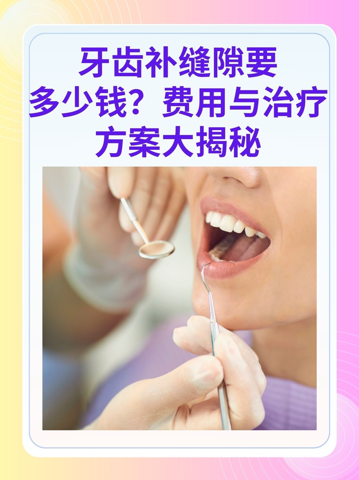 连云港补牙医保可以报销吗(补牙医保可以报销吗 哪些可以报销呢)